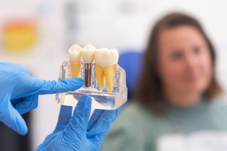 Implantes dentales en Baiona: ¿Por qué es importante la experiencia del cirujano?