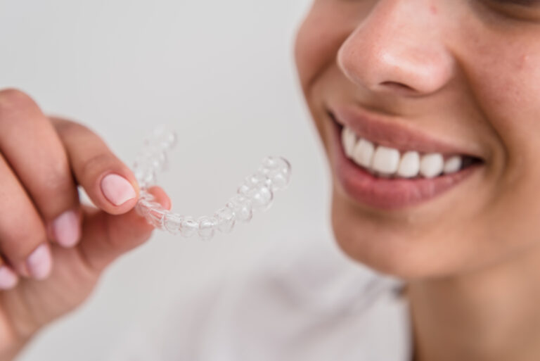 cada Cuánto Se Cambian Los Alineadores En Ortodoncia Invisible en baiona clinica dental barros